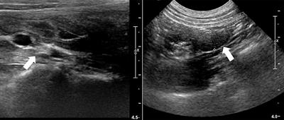 A Case of Ovarian Dysplasia and a Vaginal Fibroleiomyoma in a Young Golden Retriever